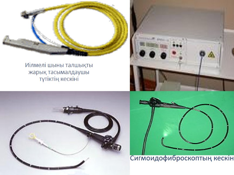 Иілмелі шыны талшықты жарық тасымалдаушы түтіктің кескіні Сигмоидофиброскоптың кескіні